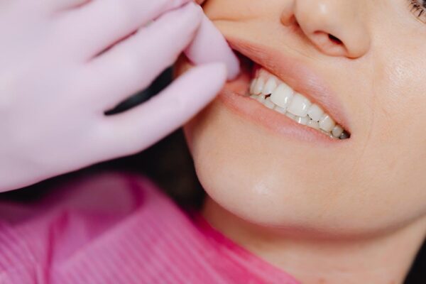 dental implants in Sarnia